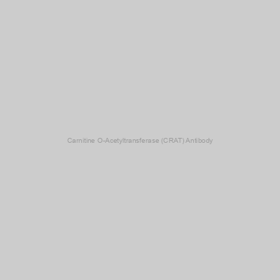 Abbexa - Carnitine O-Acetyltransferase (CRAT) Antibody